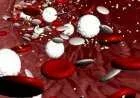 ماذا يعني تخثر الدم